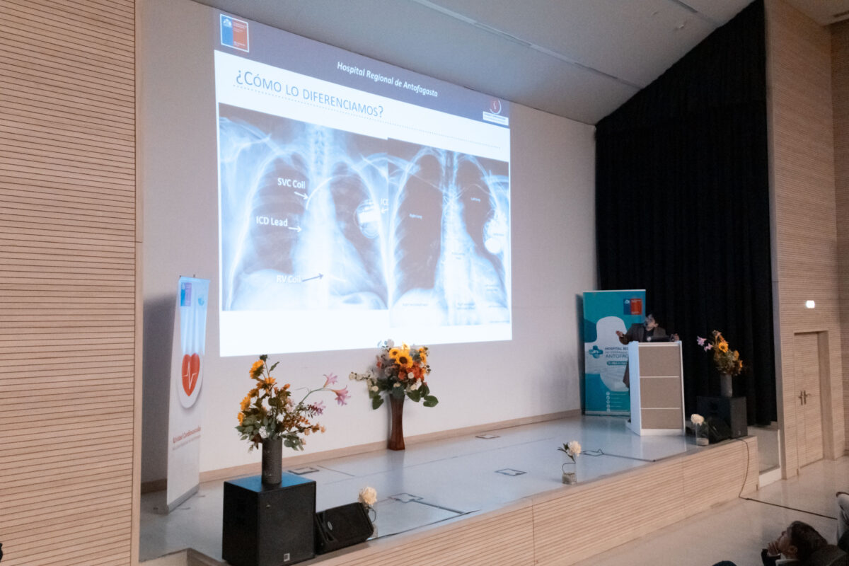 HOSPITAL REGIONAL DE ANTOFAGASTA REUNIÓ A DESTACADOS EXPERTOS CARDIOVASCULARES