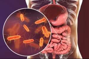 LISTERIOSIS: LA INFECCIÓN SILENCIOSA QUE PUEDE TENER GRAVES CONSECUENCIAS PARA LA SALUD