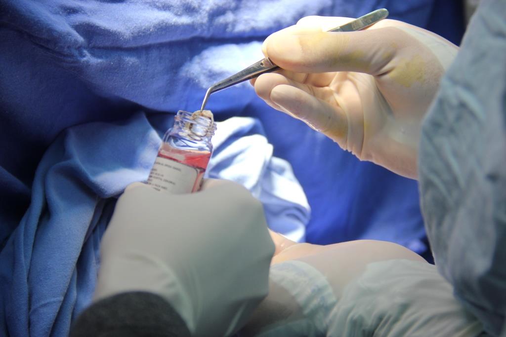 HRA DA INICIO AL PROCURAMIENTO DE TEJIDO CORNEAL, UN HITO PARA LA SALUD EN LA MACROZONA NORTE