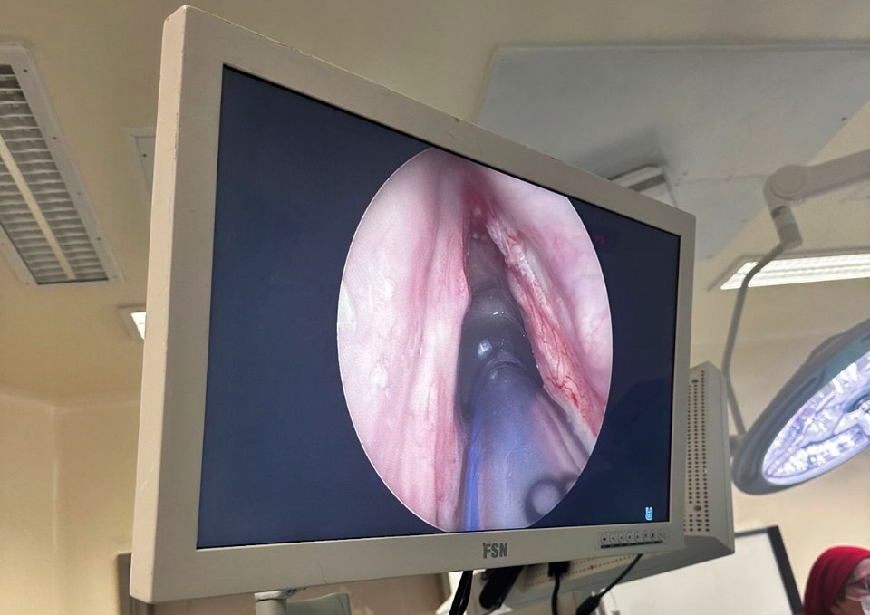 TRES CIRUGÍAS DE ALTA COMPLEJIDAD DEVUELVEN LA VOZ Y LA CONFIANZA A PACIENTES DEL HOSPITAL REGIONAL DE ANTOFAGASTA