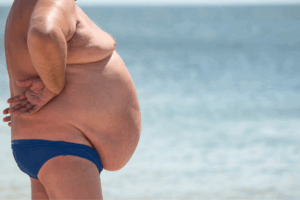 REGIÓN ANTOFAGASTA:  UNO DE CADA CUATRO ADULTOS PADECEN OBESIDAD